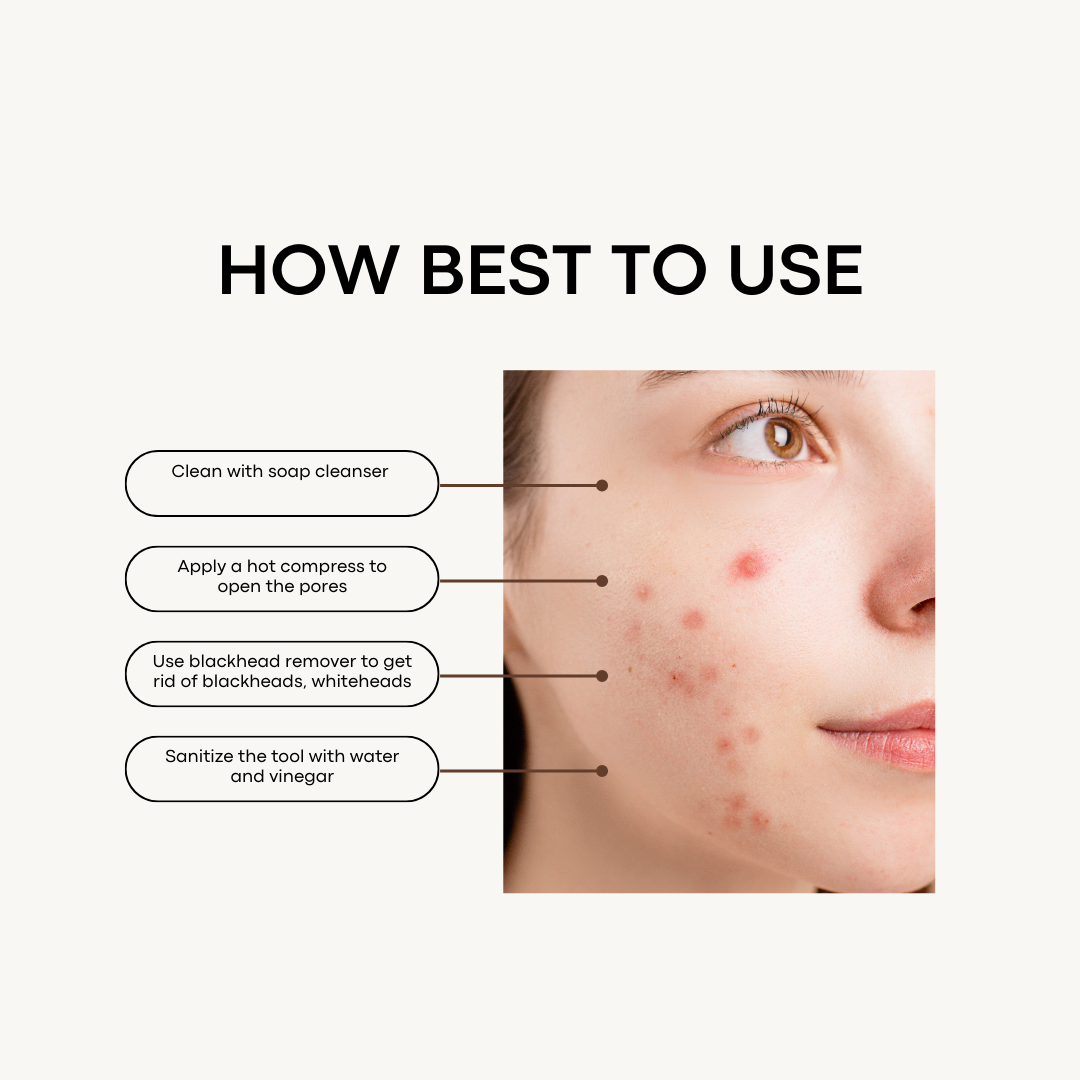 Zit Be Gone | Blackhead Remover-zoom-3