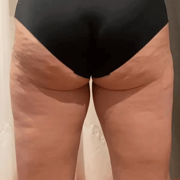 Cheek Chic Cellulite Gel-5