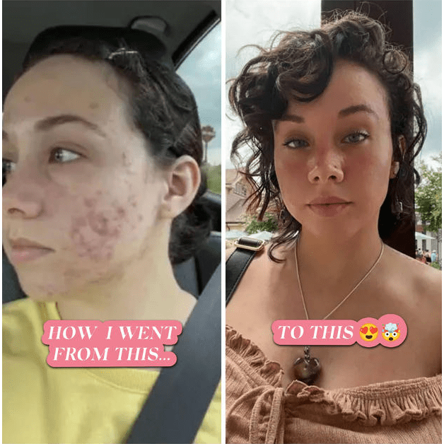 Rehab Blemish Serum