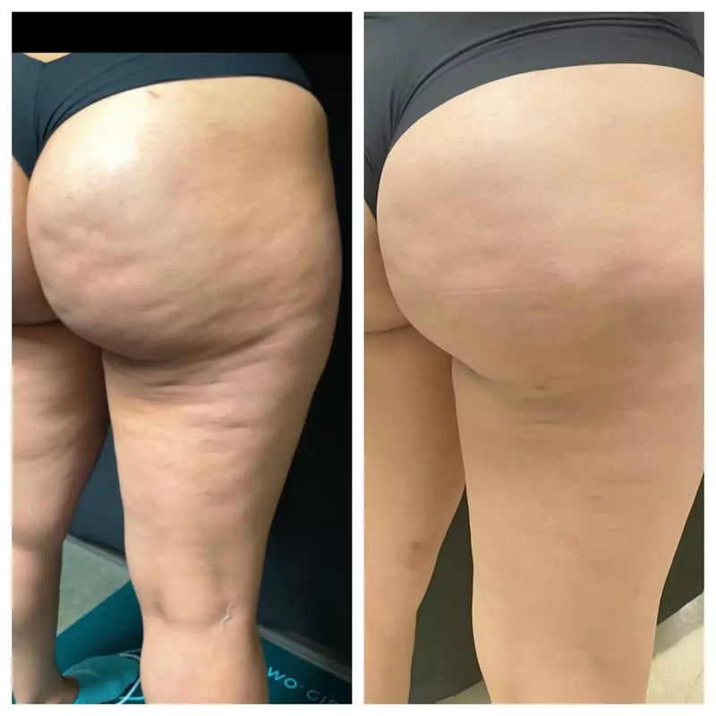 Cheek Chic Cellulite Gel-zoom-