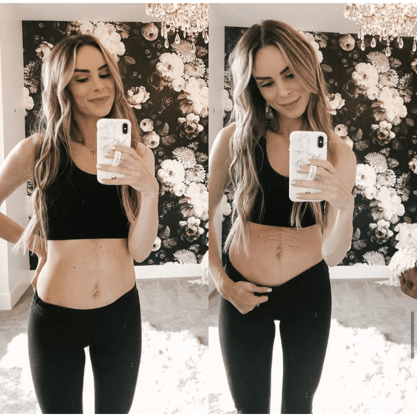 Postpartum Tummy Butter