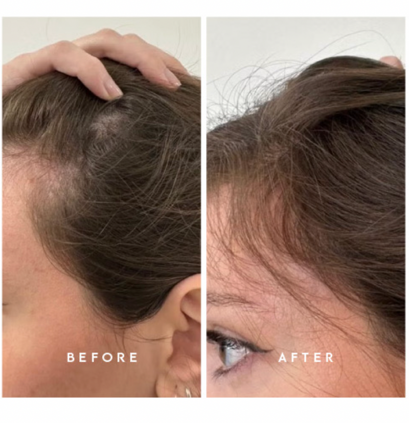 Hair She Is Hair Growth Serum-zoom-